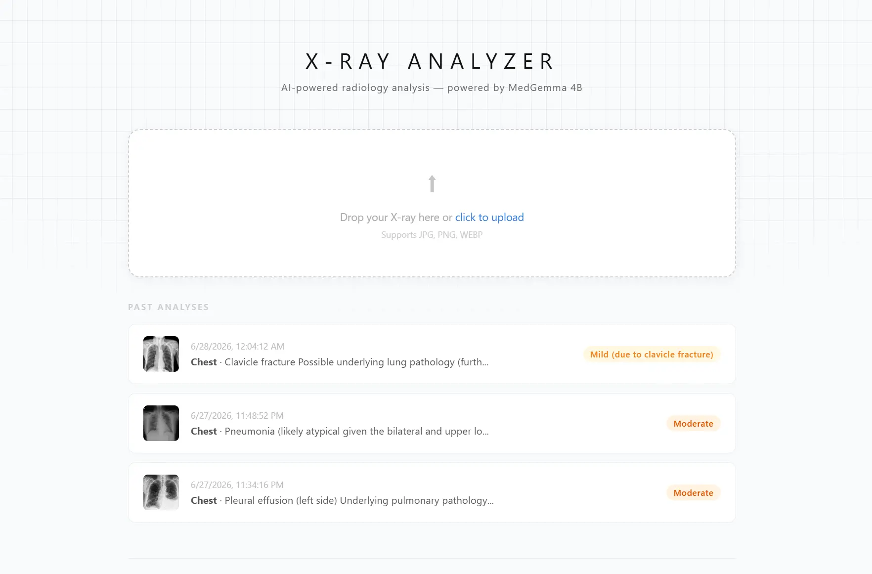 MedScan - AI X-Ray Analyzer